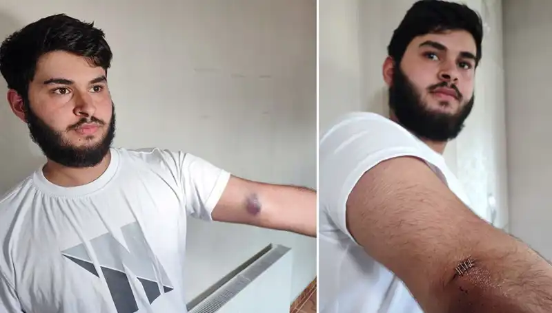 Bahçeye Kaçan Top Olayı: Mahalleni Karıştıran Conolar Kamyonetle Geldi!