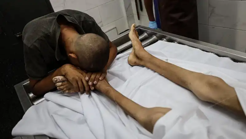 Gazze'de Açlık Lindan Çocuklar: Her Gün Yeni Bir Acı Kaybı
